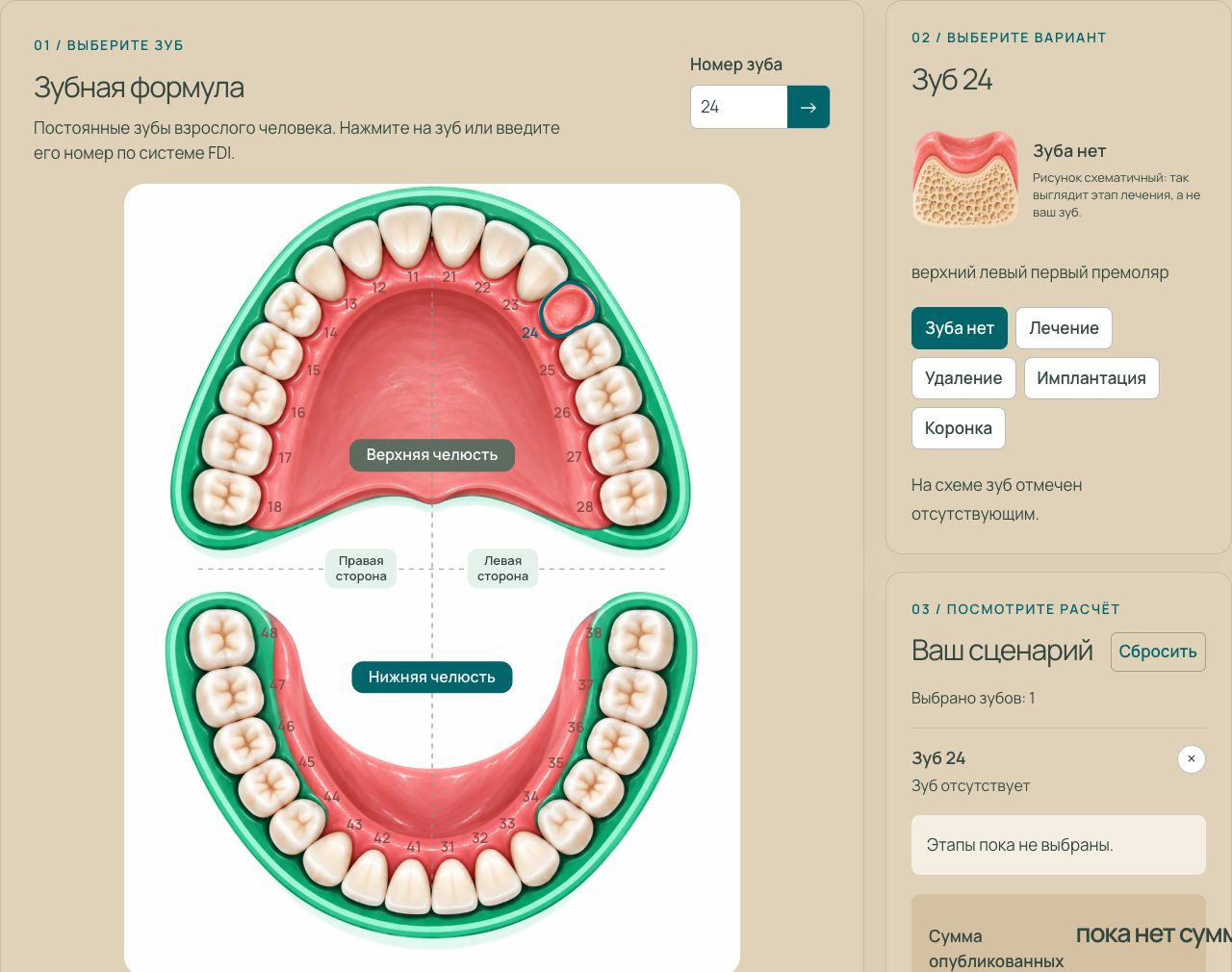 Dental chart: tooth 24 marked as missing, an empty gum on the diagram