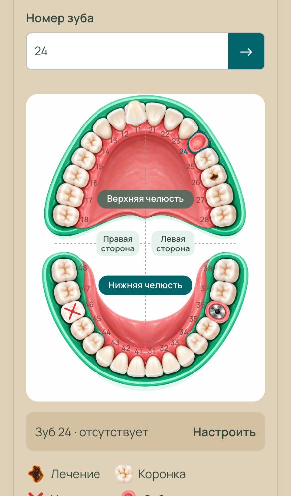 Dental chart on a phone: a crown, caries, an extraction, an implant and a missing tooth marked on the diagram